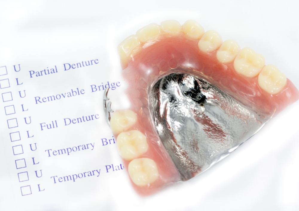 金属床義歯（自費）
