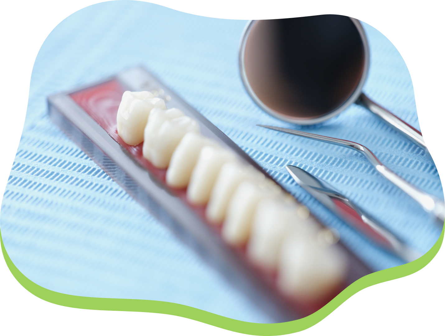 セラミック治療